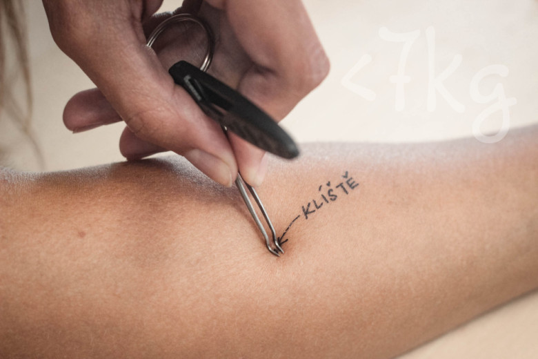 Lifesystems Compact Tick Tweezers